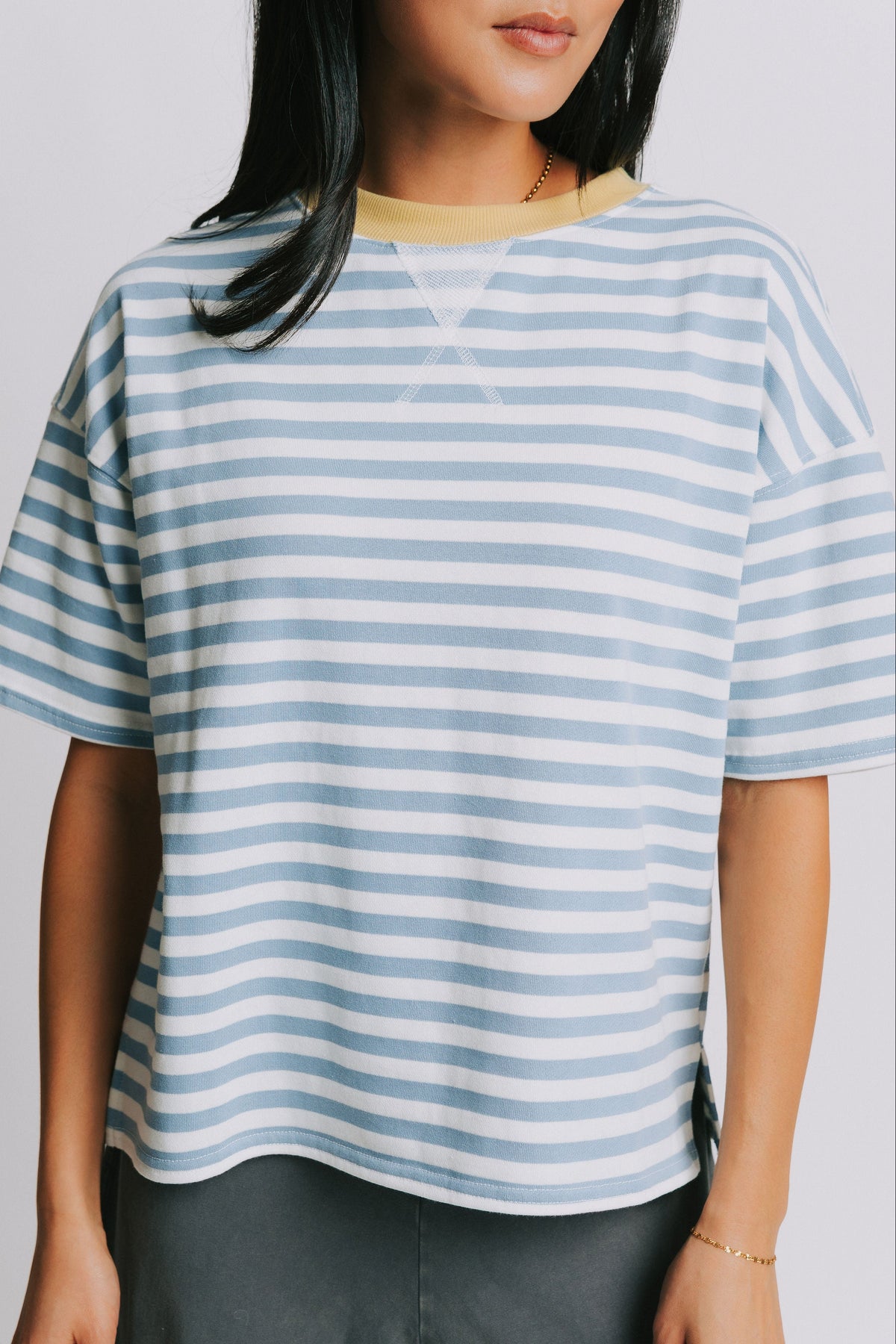 blue and white striped baggy top front